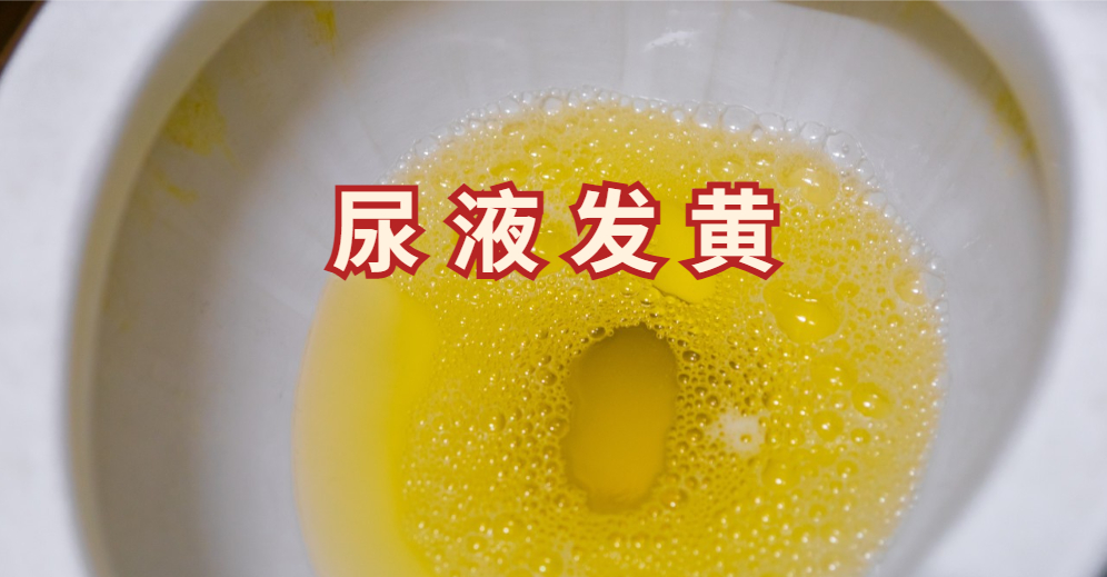 尿液发黄.jpg