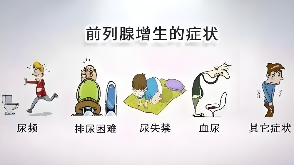 前列腺增生怎么办？