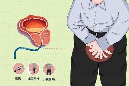 会阴坠胀属气滞血瘀？