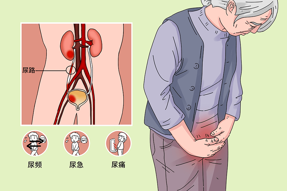 前列腺增生导致排尿困难？