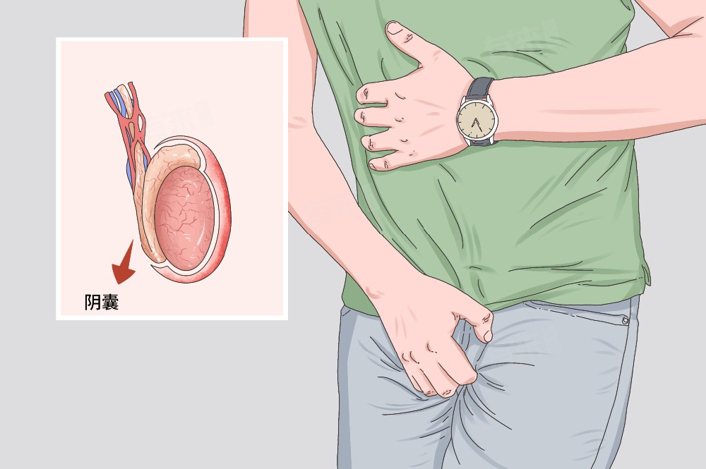 阴囊坠胀
