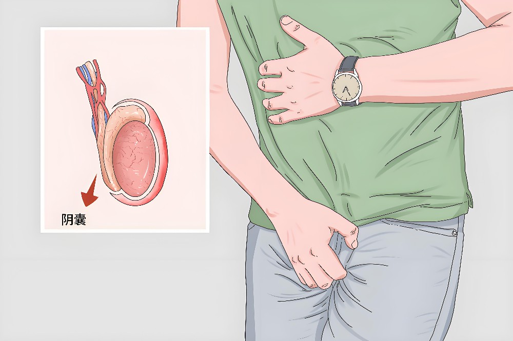 阴囊肿痛