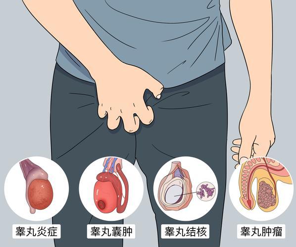 睾丸疼痛