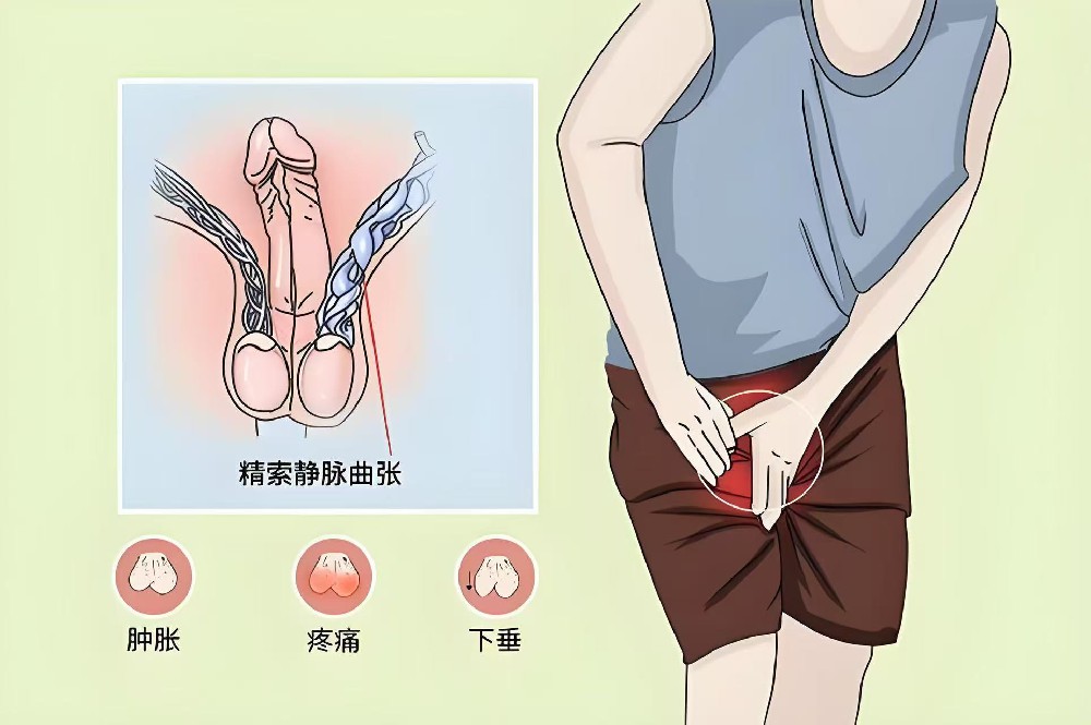 阴囊隐痛