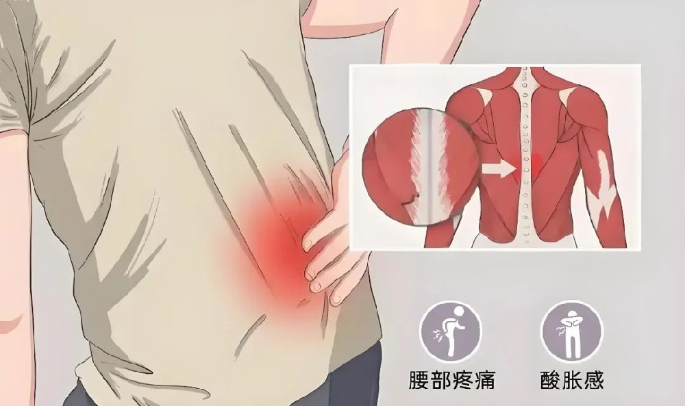 腰骶酸痛、排尿不畅