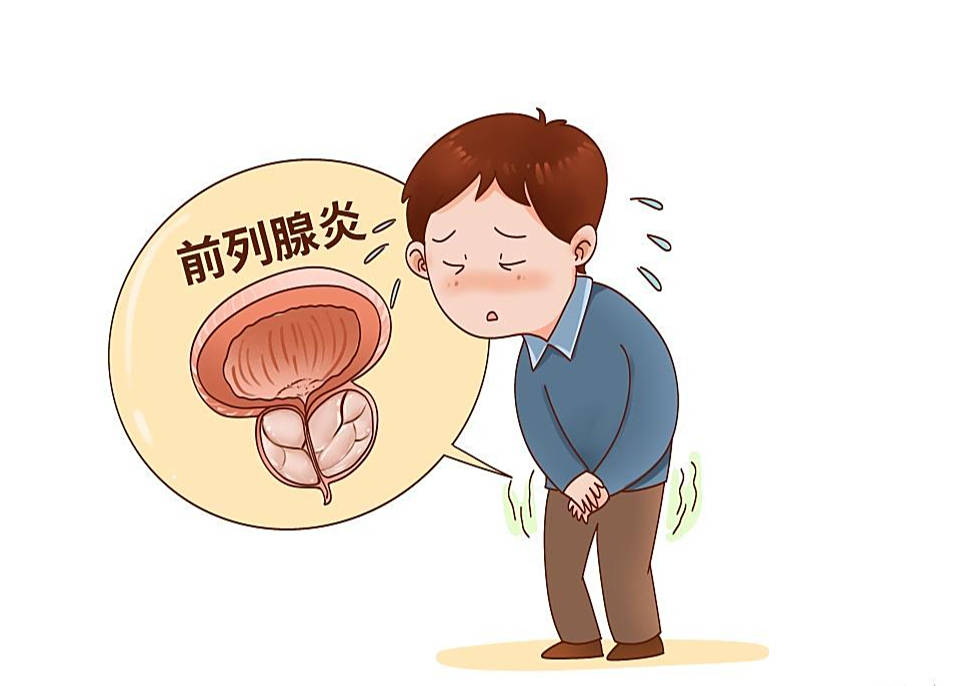 前列腺炎能根治吗?