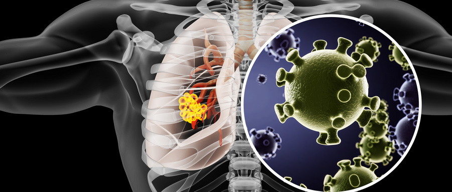 摄图网_401798235_wx_人体肺部病变场景（企业商用）.jpg