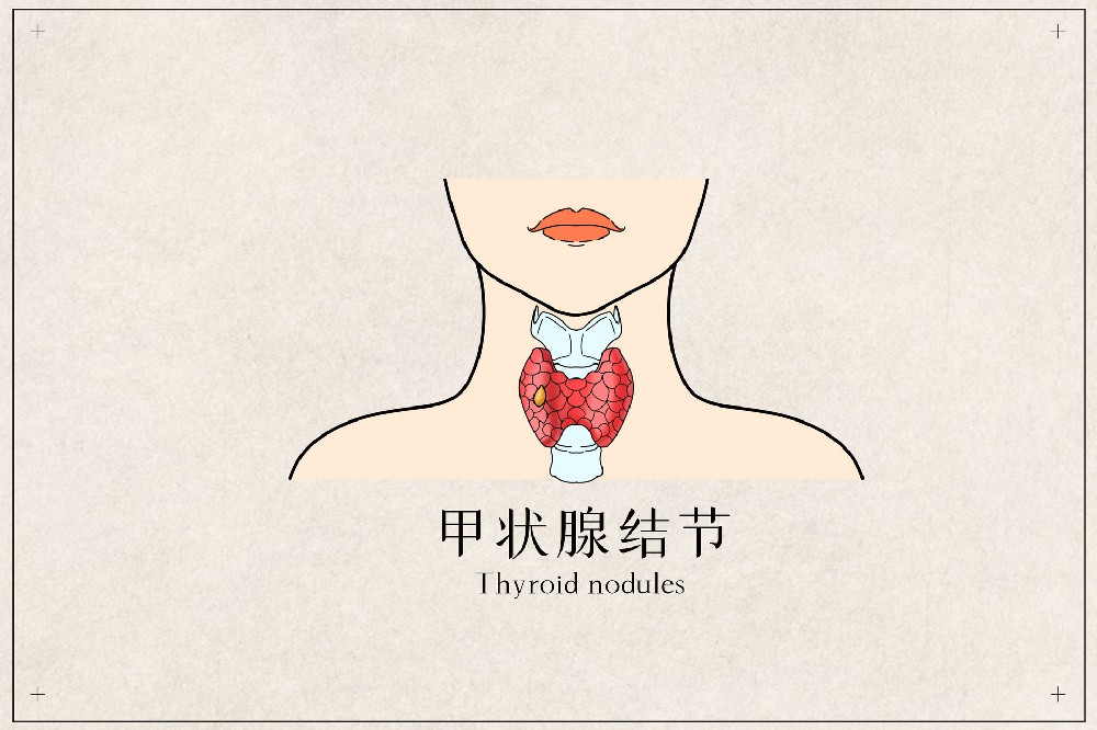 摄图网_401790424_banner_甲状腺结节医疗插画（企业商用）.jpg