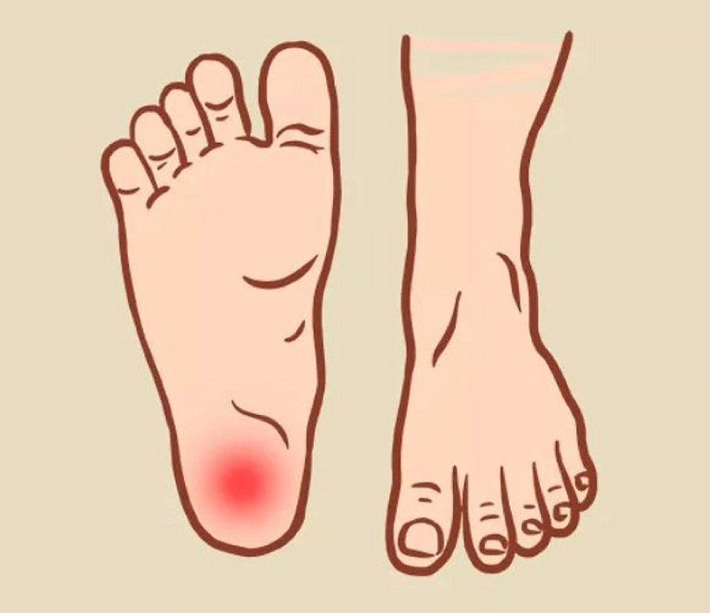 脚跟痛是肾虚引起的？